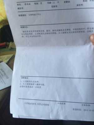 做ct怎么开单子,怎么检查头皮是不是真菌感染