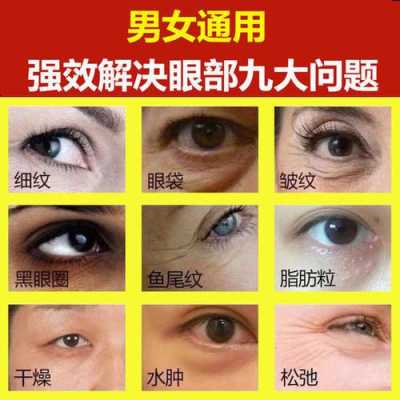 怎么消除眼纹（消除眼纹最快的方法）