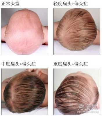 什么头型的孩子最聪明（什么头型的孩子最聪明图片）