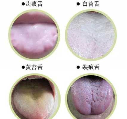 色头发黄是什么原因（为什么有些人的头发偏金黄）