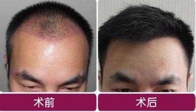 毛发发黄是缺什么原因（毛发发黄是缺什么原因引起的）