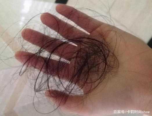 最近掉挺多新长出的细小的头发怎么回事,头发落得厉害什么原因造成的