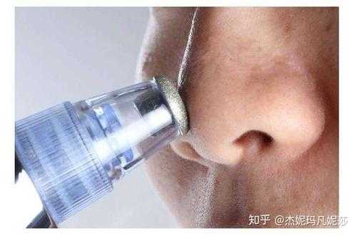 吸黑头前应该做什么,怎么样吸黑头最有效