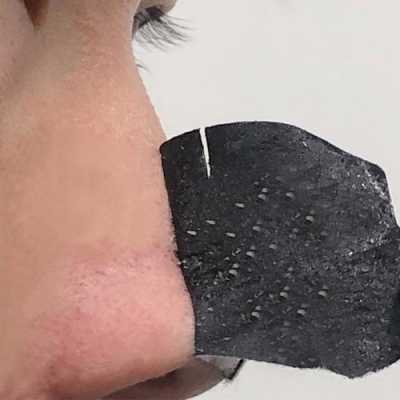 吸黑头前应该做什么,怎么样吸黑头最有效
