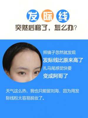 怎么预防发际线后移（保护发际线的方法）