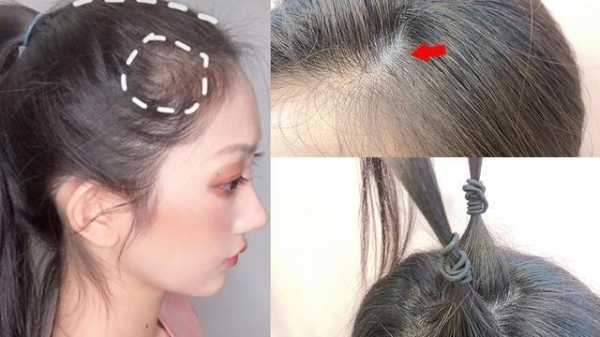 发际线太低怎么刘海（扎低马尾怎么遮住发际线）