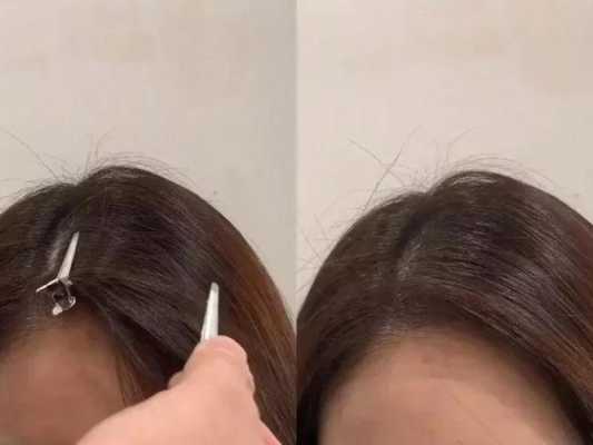 头发杂毛多弄什么发型（额头杂毛多如何整理）