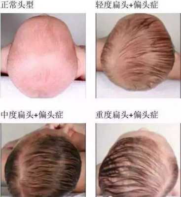 小孩怎么睡觉头型好看（小孩怎样睡觉头型好看）