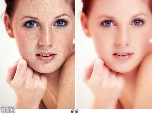 什么方法去斑快不反弹（什么方法去斑快不反弹呢）