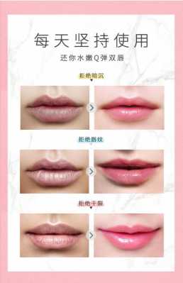 唇纹淡化方法,唇纹怎么改善医美方法