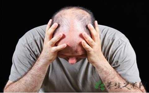 什么原因掉头发厉害（严重掉发是什么原因）