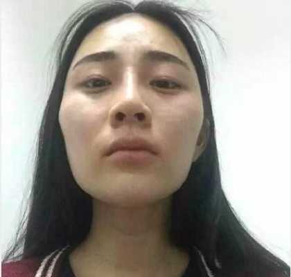 颧骨怎么样好看（有颧骨好看还是没颧骨好看）