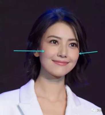 颧骨怎么样好看（有颧骨好看还是没颧骨好看）