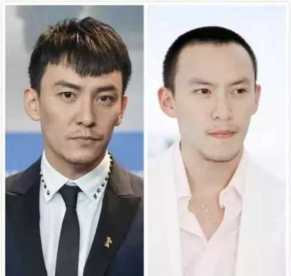 男的发际线高代表什么（男人发际线高的人命运）