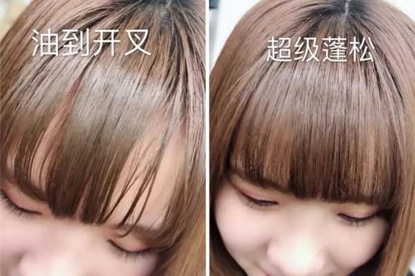 很多短头发怎么办（头发发根短，而且头发很细，出油厉害,怎样预防和治疗脱发）