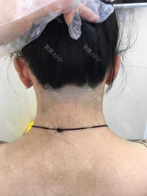 颈部后面头发长得太靠下怎么解决,后颈发际线怎么剃图解女