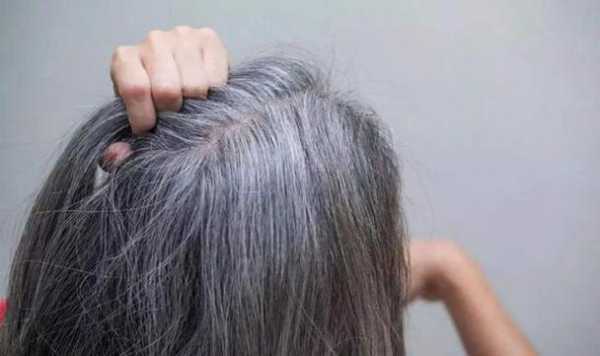头中心有白发什么原因（头中心有白发什么原因女性）