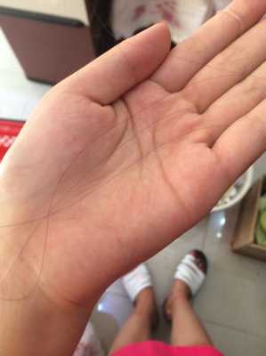 为什么掉发特别严重（为什么掉发特别严重,用手一抓就有）