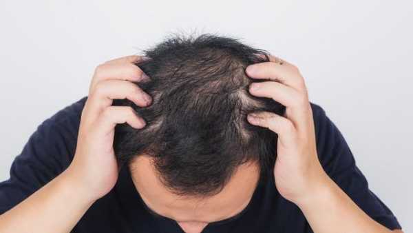 男的烫完头发可以洗头吗?可以经常洗吗,长期洗头发有什么危害吗