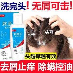 男生头皮屑多，用什么洗发水,男生头屑多是什么原因造成的