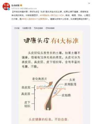 脱发是何原因,脱发主要是什么原因引起的