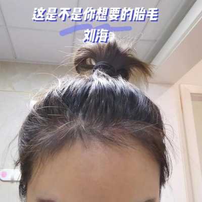 怎么可以让发际线变低（怎样让发际线变低）