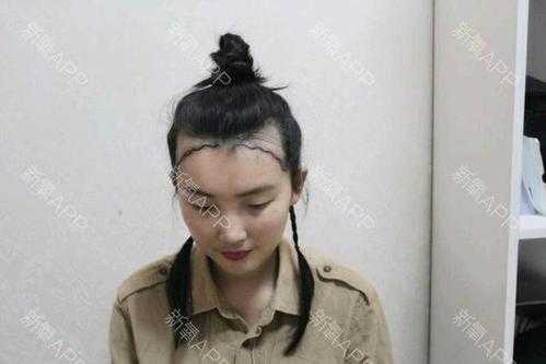 怎么可以让发际线变低（怎样让发际线变低）