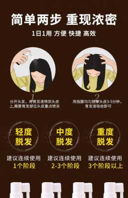 掉发脱发严重怎么办,掉发脱发怎么办怎么增发