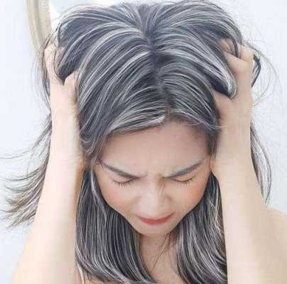 女人长白发是什么原因（为什么女生有少年白）