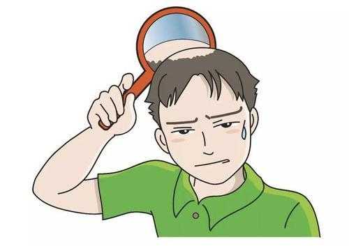 青年脱发是什么原因,年青人脱发是什么原因引起的