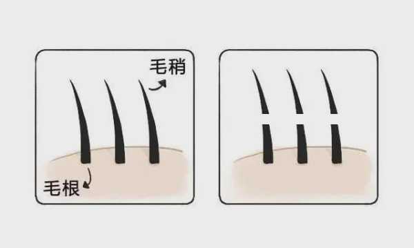 毛发长的快是什么原因（汗毛长得太快怎么办）