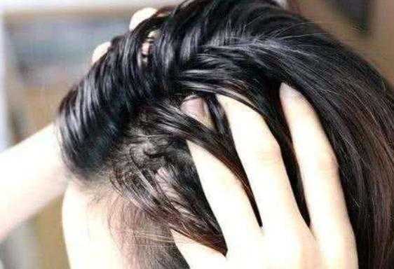 怎么去屑止痒最有效（去屑止痒最好的小妙招）