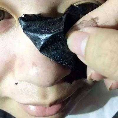 怎么去黑头效果最快最好,怎么快速有效的去黑头的方法