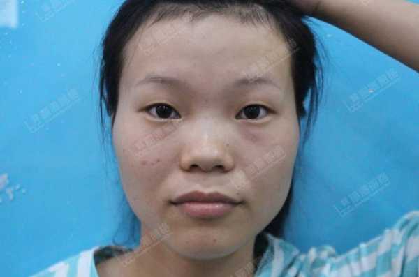 塌鼻梁是什么样的图片（塌鼻梁是什么样的图片大全）