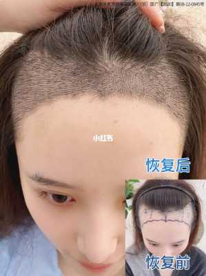 后发际线低怎么调整（后发际线低怎么调整发型）