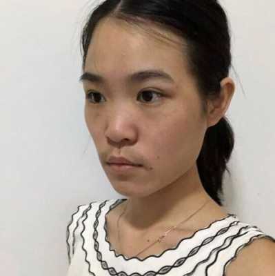 长胖就长脸怎么回事（长胖就长脸怎么回事啊）