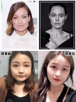 长胖就长脸怎么回事（长胖就长脸怎么回事啊）