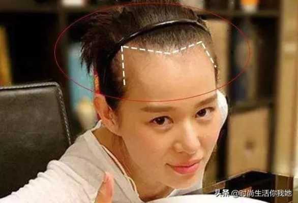 发际线高额头大适合什么发型（额头大发际线高如何挽救）