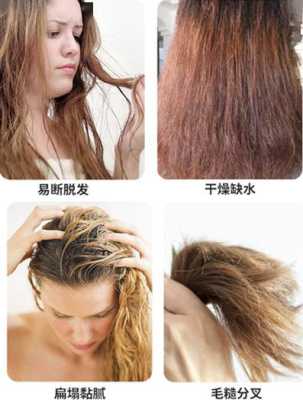 解决头发出油的方法,很油的头发怎么办才能蓬松