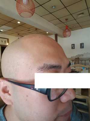 头帘剪秃了怎么补救,头帘剪短了怎么补救男生