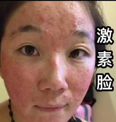 脸堵塞怎么办图片（脸堵塞怎么办图片大全）