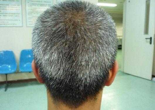 为什么会有一根白头发（为什么会有一根白头发出现）