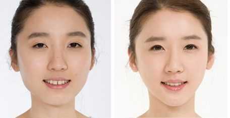 脸怎么变瓜子脸（怎样变成瓜子脸）
