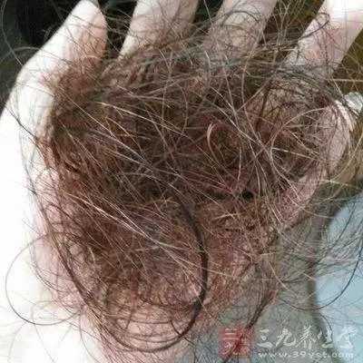 为什么掉发主要原因是（为什么掉发会这么严重）