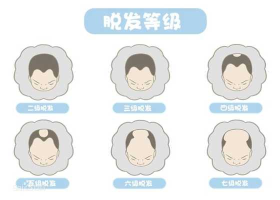 脑筋急转弯年轻人为什么掉头发,年轻人脱发是什么原因引起的呢
