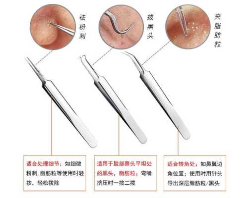 粉刺针清脸后如何修复,用了粉刺针后怎么护理皮肤