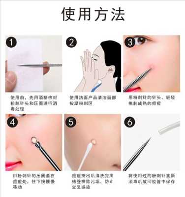 粉刺针清脸后如何修复,用了粉刺针后怎么护理皮肤