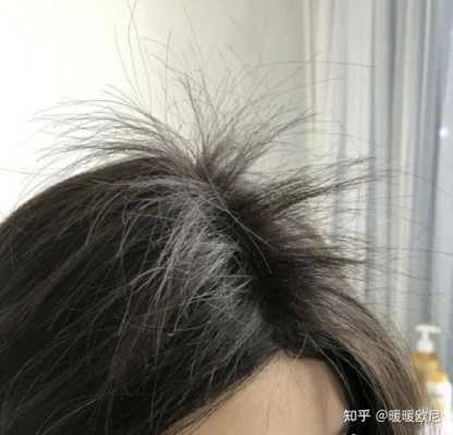 为什么新长出来的头发是卷的（为什么新长出来的头发是卷的呢）