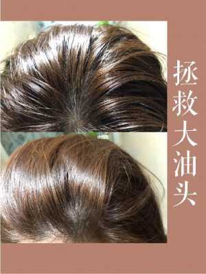 头发油油的怎么快速解决,天天洗头导致头发油该怎么办