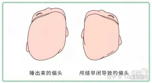 男童偏头适合什么样的发型,偏头适合什么发型?